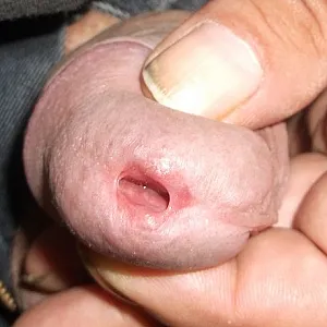 Das erste Bild von sperma12's Galerie - eichelloch