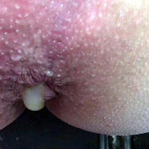 Das erste Bild von Paar0365's Galerie - Fotzen und Arschfick creampie