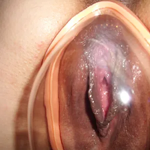 pumping gallery image