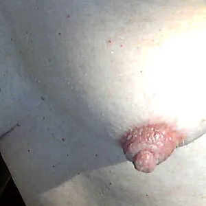 nipples gallery image