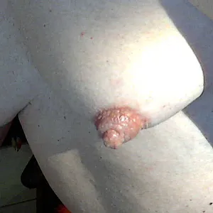 nipples gallery image