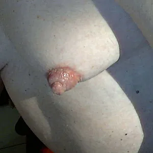 nipples gallery image