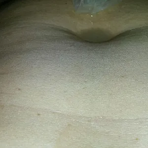 condom with sperm in gallery image