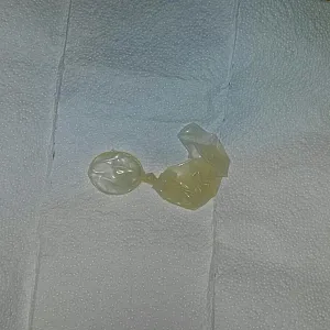 condom with sperm in gallery image