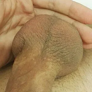 my cock gallery image
