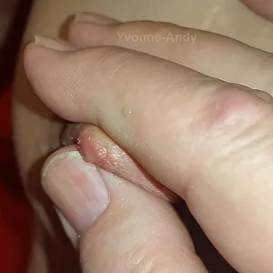 Neues Spielzeug - Extrem Nipplepumpe Galeriebild