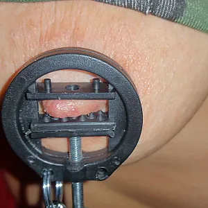 Neues Spielzeug - Extrem Nipplepumpe Galeriebild