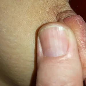 Neues Spielzeug - Extrem Nipplepumpe Galeriebild