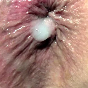 assfuck and more gallery image