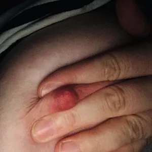 nipples gallery image