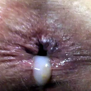 Anal und Fotzencreampie Galeriebild