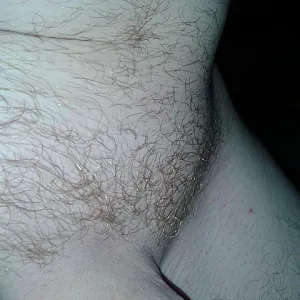 red hairs gallery image