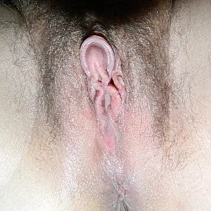 Hairy Galeriebild