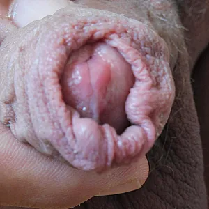 closeups gallery image
