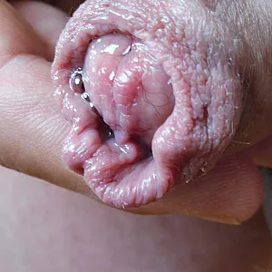 closeups gallery image