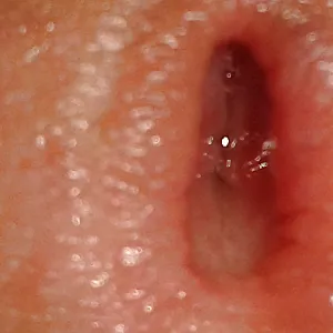 my cock gallery image