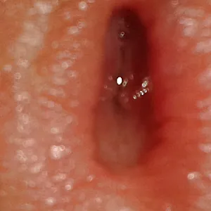 my cock gallery image
