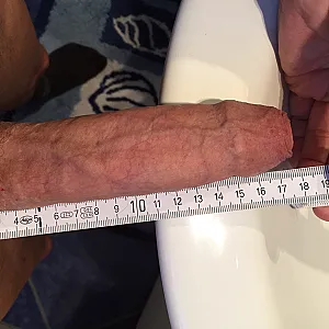 Penis gallery image