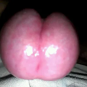 my cock gallery image