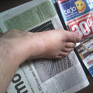 my feets gallery image