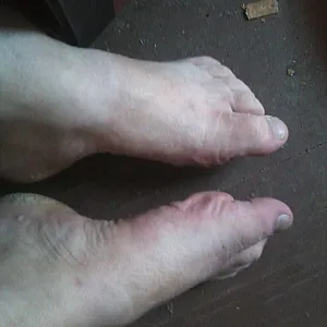 my feets gallery image