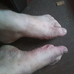 my feets gallery image