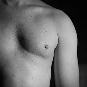 my breast gallery image