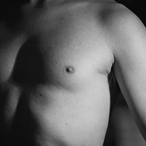 my breast gallery image