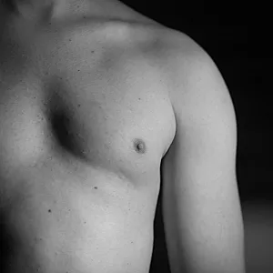 my breast gallery image