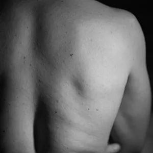 my breast gallery image