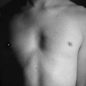 my breast gallery image