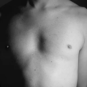 my breast gallery image