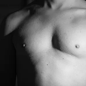 my breast gallery image
