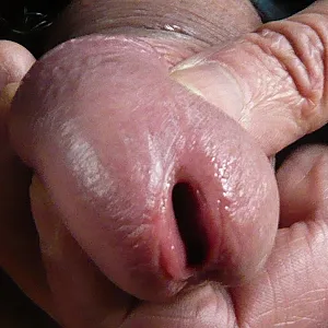 my cock gallery image