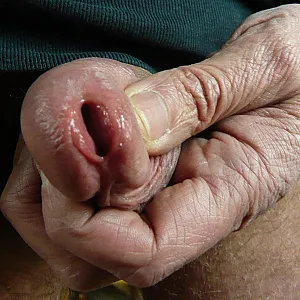 my cock gallery image