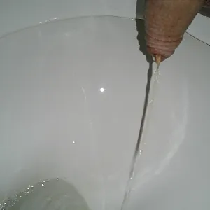 pee gallery image