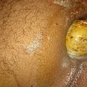 potatoe gallery image