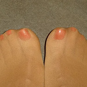 Nylons Galeriebild