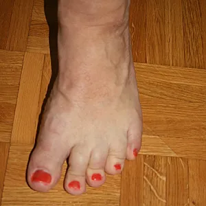 cared feets gallery image
