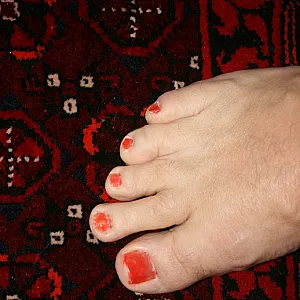 cared feets gallery image