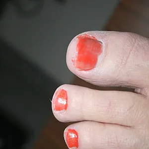 cared feets gallery image