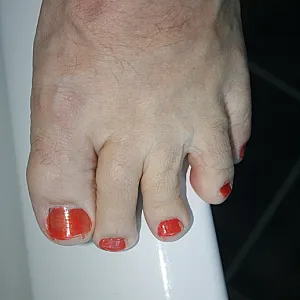 cared feets gallery image