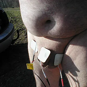 e stim and pumping gallery image