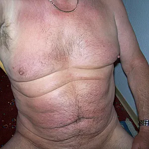 FKK Galeriebild