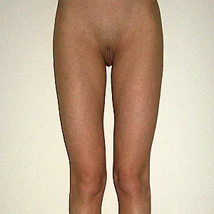 body shots Galeriebild