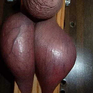 First image of Frank_10's Gallery - 