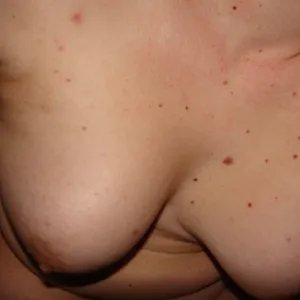 me and my hole gallery image