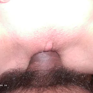 Anal Galeriebild