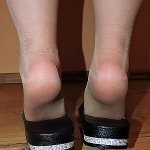 Geil in Nylons mit langen Schamlippen Galeriebild