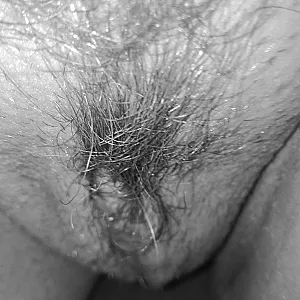 hairy gallery image